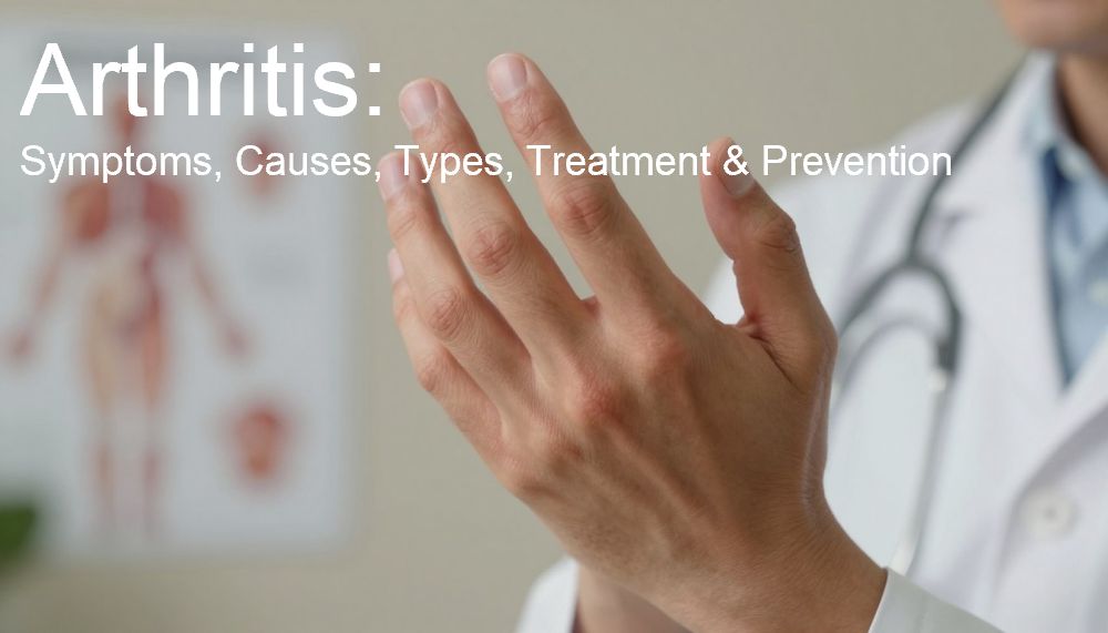 Arthritis: Symptoms, Causes, Types, Treatment & Prevention